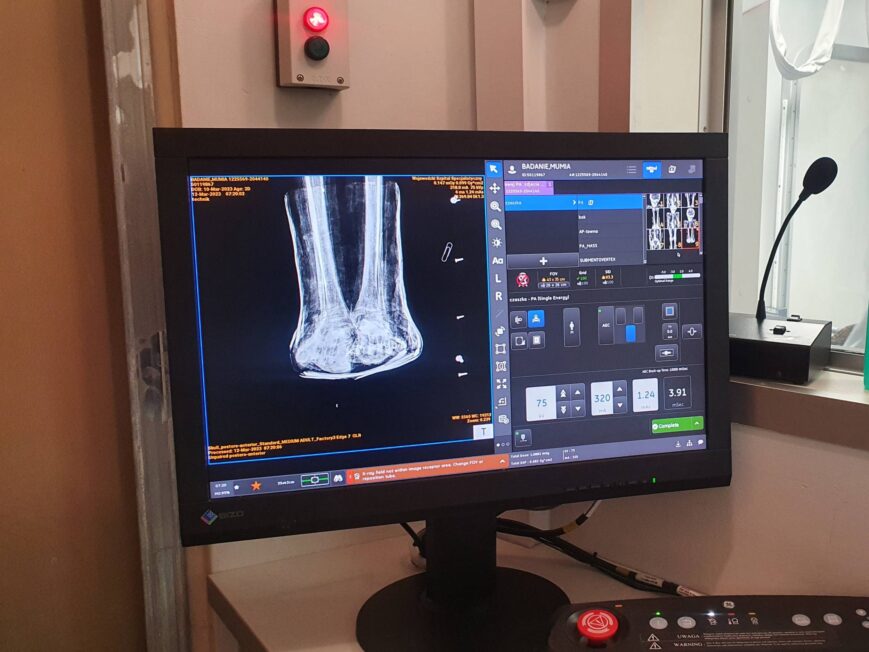 Zdjęcie rentgenowskie dolnej części mumii. Badanie RTG pozwoliło ocenić stan zachowania kości stóp oraz zidentyfikować ewentualne uszkodzenia wtórne.