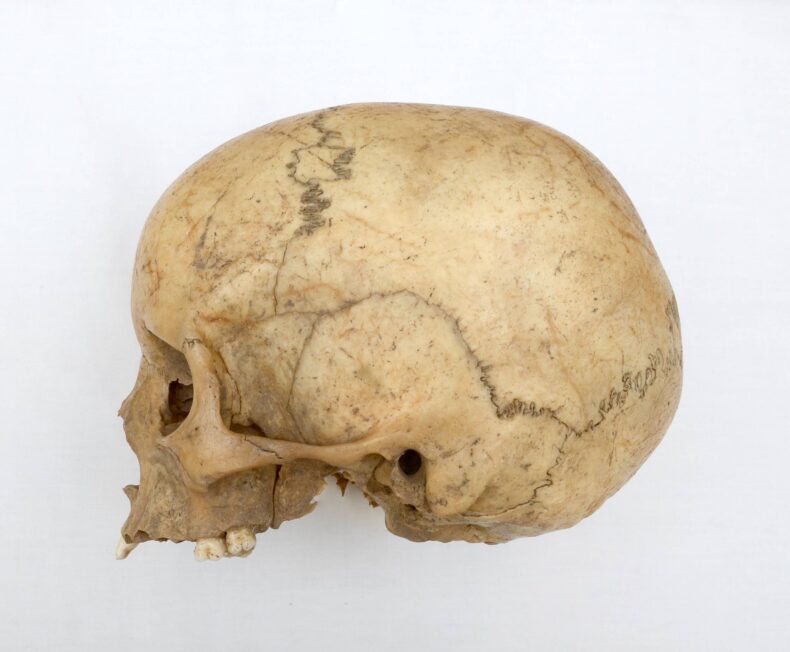 Czaszka dziewczynki z obiektu 65 odkrytego na stanowisku w Nowej Cerekwi