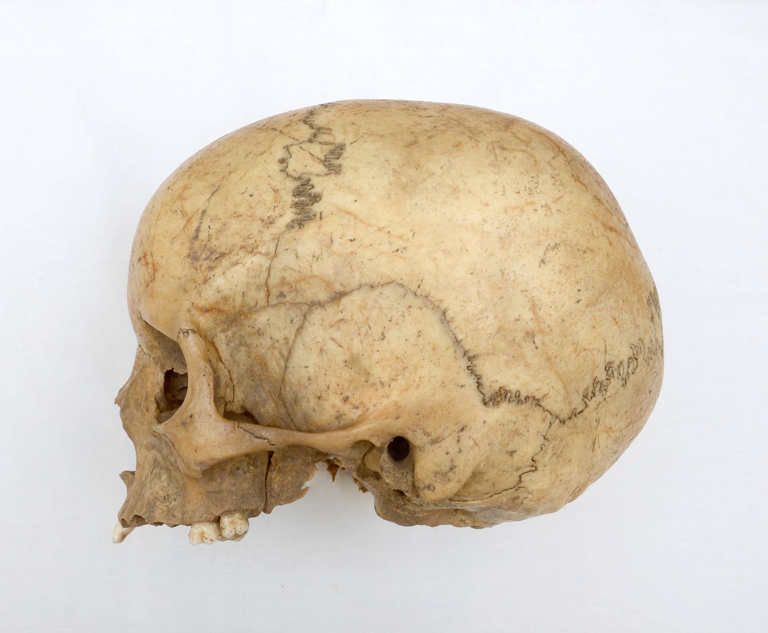 Czaszka dziewczynki z obiektu 65 odkrytego na stanowisku w Nowej Cerekwi